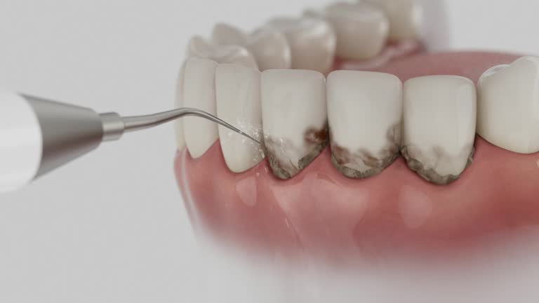 Trusted Teeth Cleaning And Checkup service in Hidalgo, TX - Dentist Open Now